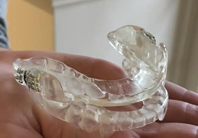 mandibular device advancement dental mad sleep snoring leeming advance appliances remedies jaw refreshed wake better sutured splints lower pull