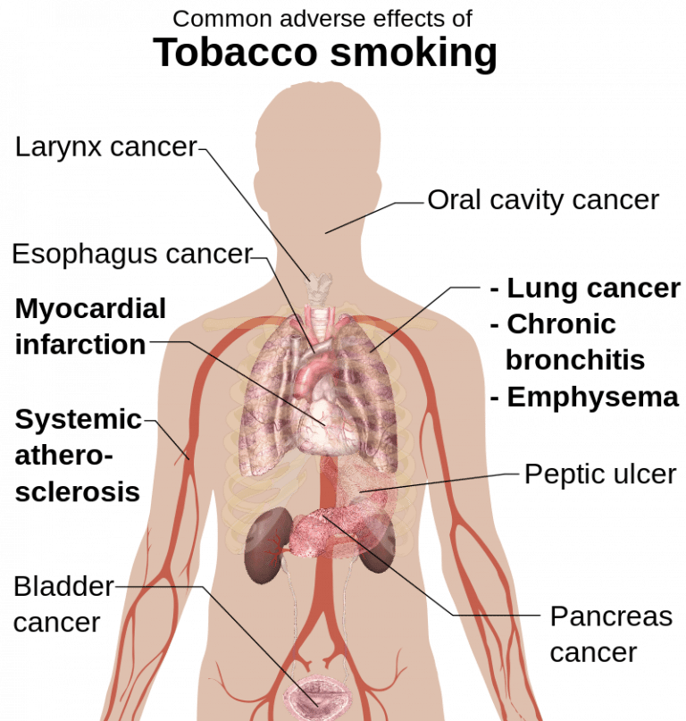 list-of-diseases-caused-by-smoking-sutured