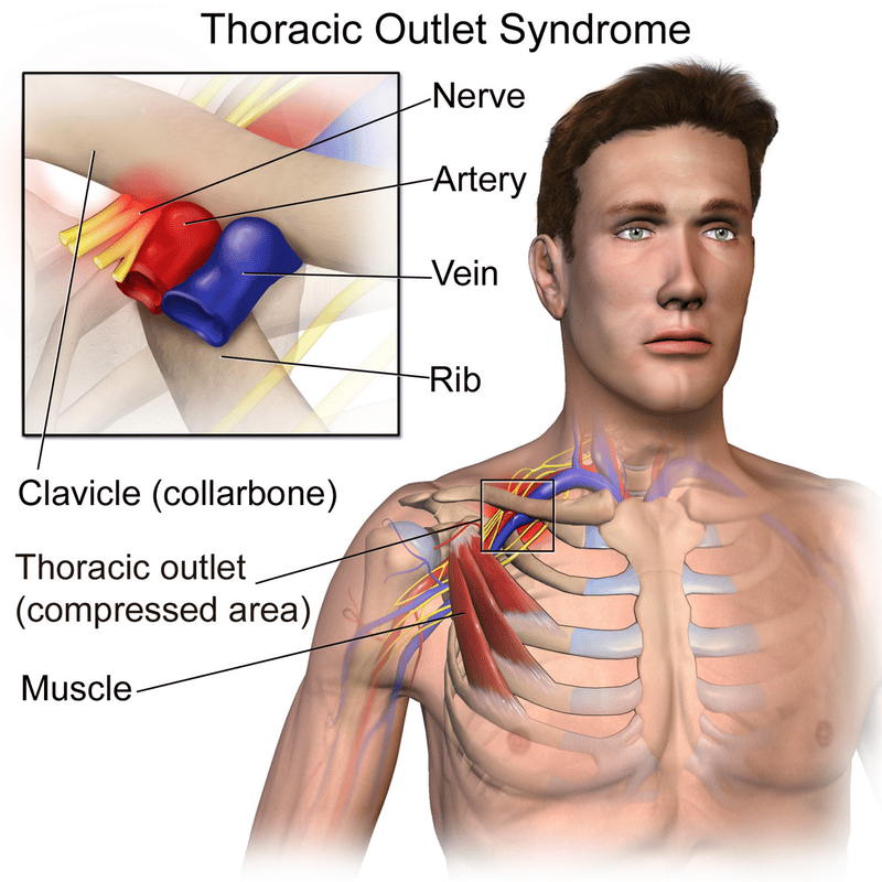 rib-removal-surgery-cost-importance-and-risks-sutured