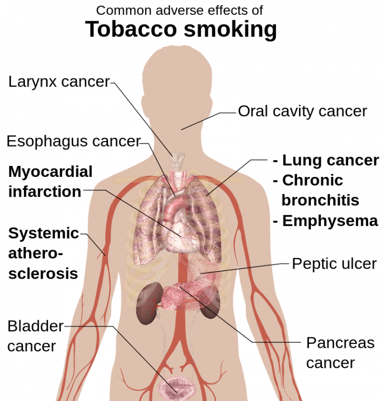 10 Diseases Caused By Smoking Sutured 