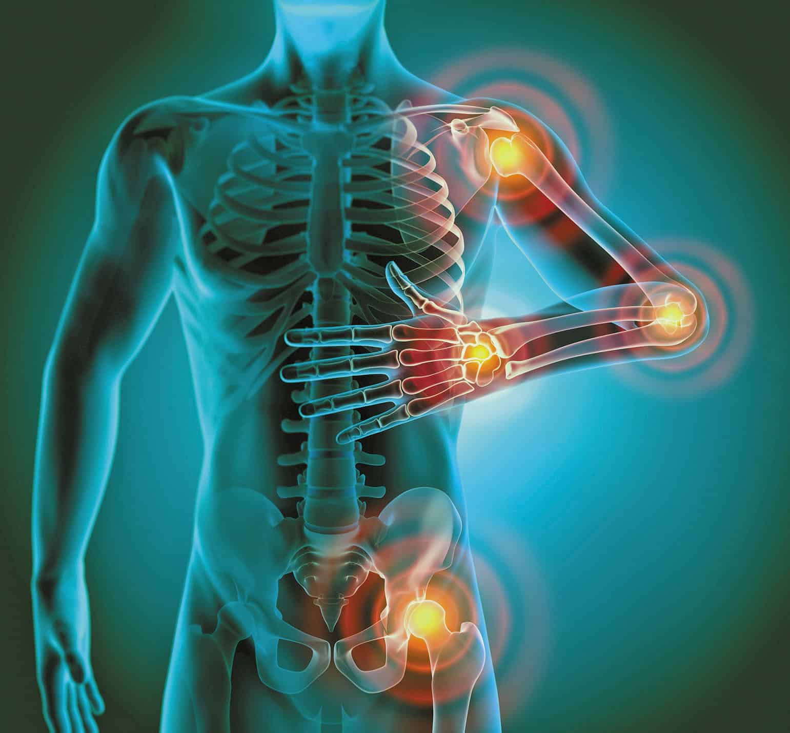 what-is-chronic-inflammation-sutured